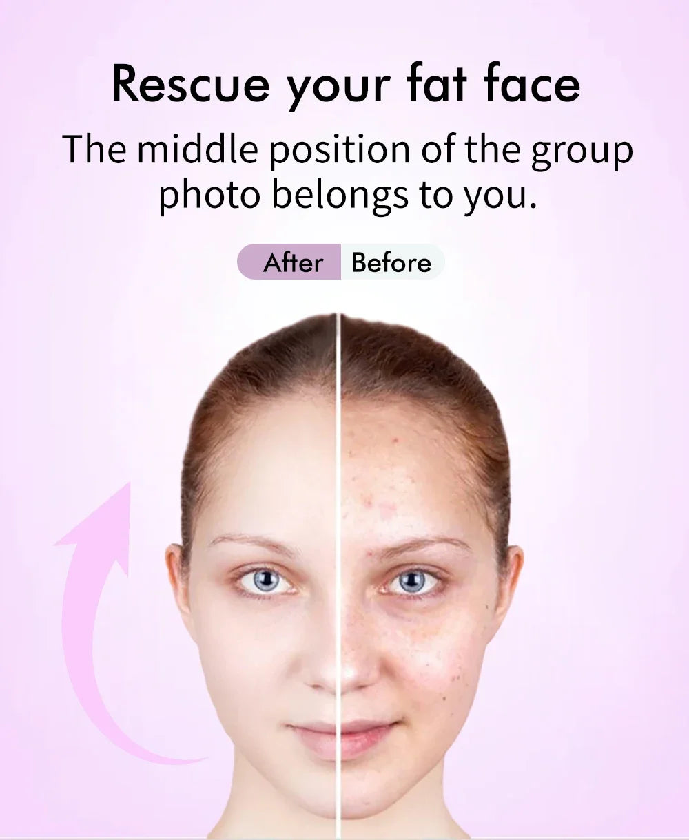 EMS 5 in 1 Facial Massager 4D Massage Head Home Use Facial Device Promote Face Cream Absorption 5 Light Color Modes Beauty Tools