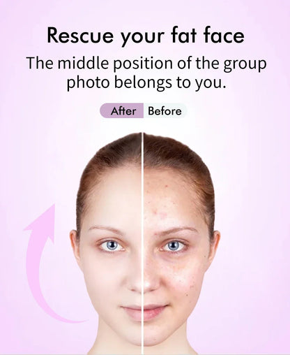 EMS 5 in 1 Facial Massager 4D Massage Head Home Use Facial Device Promote Face Cream Absorption 5 Light Color Modes Beauty Tools