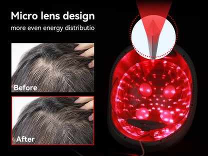 Hair Growth Cap Anti Hair Loss Hair Growth Laser Helmet Hat Hair Regrowth Light Therapy Device Hair Growth Treatment Hat Machine