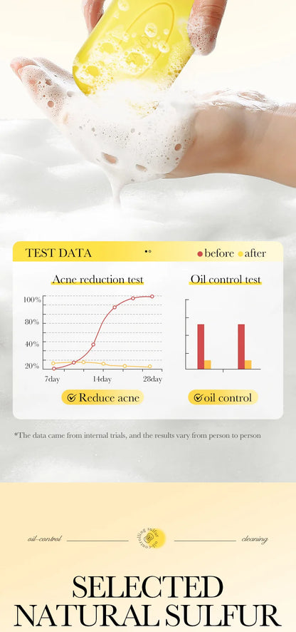 1/2pcs SADOER Sulfur Mite Removing Facial Soap Universal Handmade Soap for Body Face Wash Foam Moisturizing Facial Cleanser